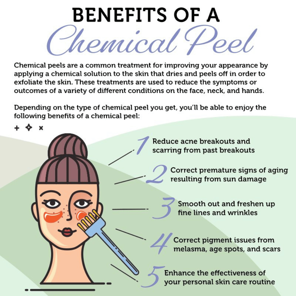 chemical peel benefits infographic