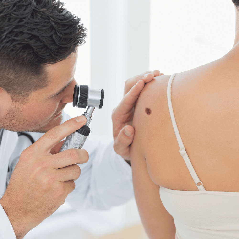 dermatologist studying a dark spot on the back of a woman's shoulder with a magnifier