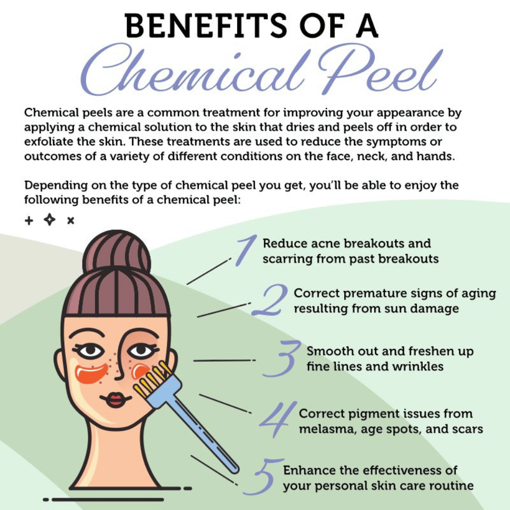 8 Ways To Keep Your Skin Hydrated After A Chemical Peel The Best Moisturizers For The Job
